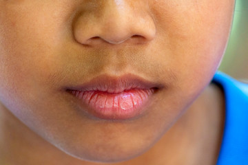 Obraz premium Close-up of nose and mouth of Asian girls in Thailand.