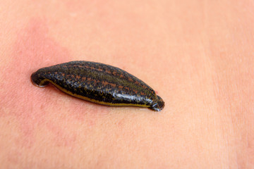 Tropical land leech sucking some blood from the skin.