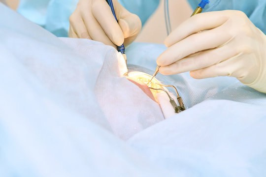 People at hospital background. Blue medical backdrop. Healthcare support. Cardiology sick patient. Ophtalmology medicine device. Operation room inside. Eye clinic concept