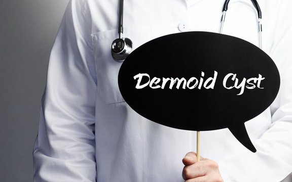 Dermoid Cyst. Doctor in smock holds up speech bubble. The term Dermoid Cyst is in the sign. Symbol of illness, health, medicine