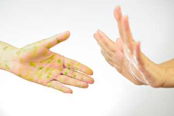Rejection of The hand that simulates the infection of the patient
