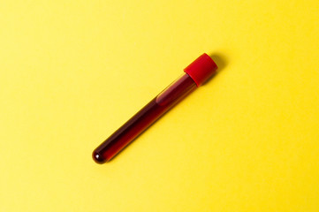 Test tube with blood isolate on a yellow background