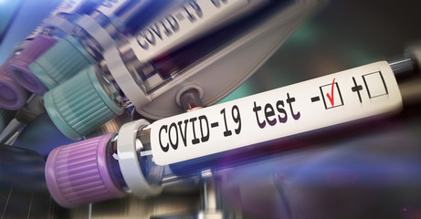 Negative COVID-19 test and laboratory sample of blood testing for diagnosis new Corona virus infection novel corona virus disease 2019 from Wuhan. Pandemic infectious concept 3D