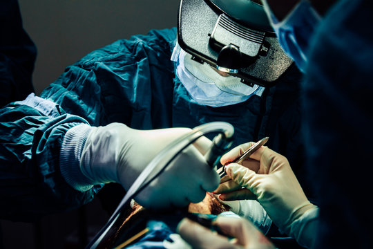 Close Up Doctor With Surgical Tools Making Surgery In The Operating Room, Baldness Treatment, Hair Transplant