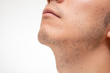 髭脱毛　beforeイメージ　3日間処理してない髭