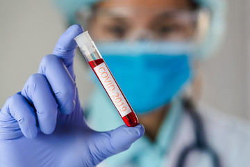 Doctor holding test tube with blood sample for COVID-19 test, novel coronavirus 2019.