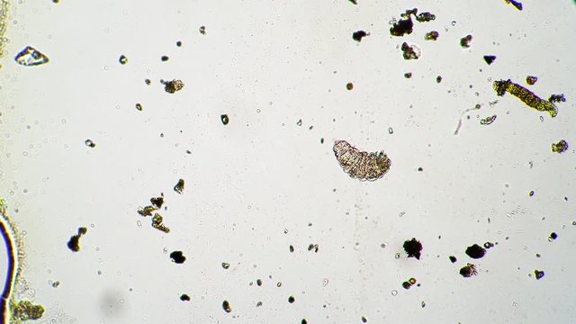 The tardigrade is laying on it's back and tries to flip over moving it's paws. Small moss piglet is bowing and tries to walk between algae and dirt pieces. Theme of microcosmos and it's inhabitants.