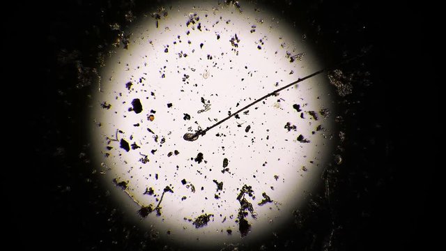 The little tardigrade is crawling the stick in light circle under the microscope. Small animal is moving in the plash between algae and bacteria. Theme of small creatures living in our world.