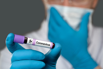 Coronavirus 2019-nCoV Blood Sample.