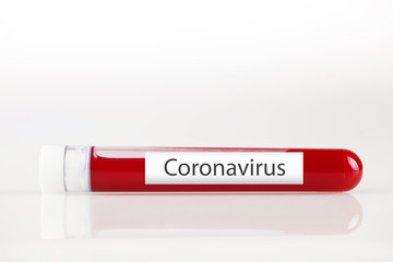 Test tube with blood and white sticker on white. Background with copy space. Coronavirus. Horizontal.