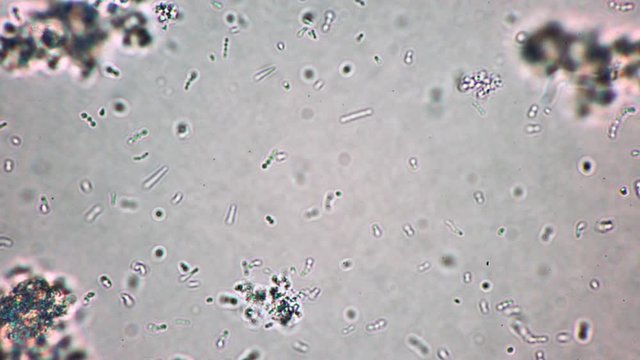 Many small bifid bacterium are moving in fermented dairy product in magnification. Tiny blue and green cells of different shapes are floating under the microscope. Theme of useful microorganisms.