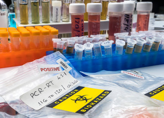 Vials with samples of SARS-COV-2 Covid-19 in a research laboratory, conceptual image