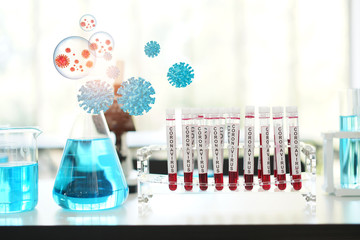 coronavirus covid 19 check, researchers are finding ways to eliminate the corona virus vaccine....
