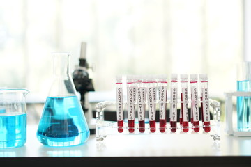 coronavirus covid 19 check, researchers are finding ways to eliminate the corona virus vaccine....