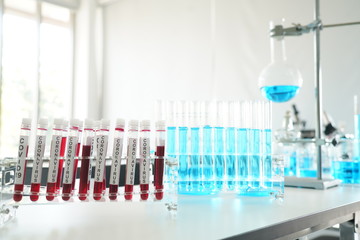 coronavirus covid 19 check, researchers are finding ways to eliminate the corona virus vaccine....