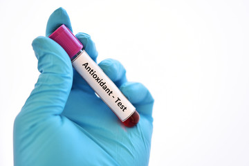 Fototapeta premium Test tube contain with blood sample for antioxidant test