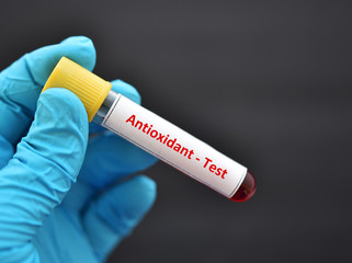 Obraz premium Test tube contain with blood sample for antioxidant test