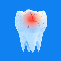 Broken molar tooth with red dot on blue background. Cracked Enamel Concept. The concept of sick brittle teeth, tooth crumble. 3d illustration