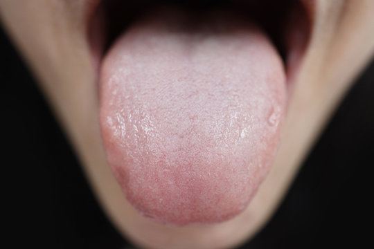 Lose Up On Taste Bud On Woman Tongue