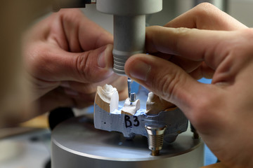 Close-up of male dental technician's hands using a dental drill on tooth model to create an implant denture in a modern dental laboratory.