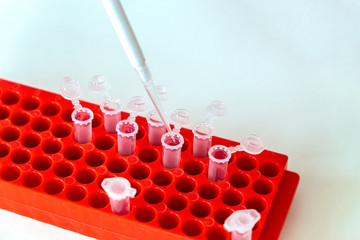 Top view on laboratory table with digital pipette dispenses liquid from a flask into test tubes....