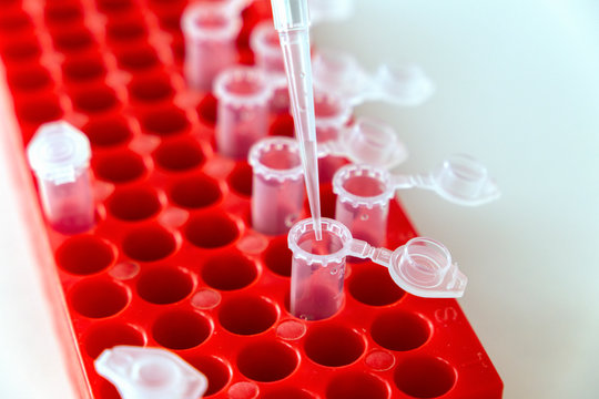 Closeup digital pipette dispenses liquid from a flask into test tubes. Modern medical laboratory concept.