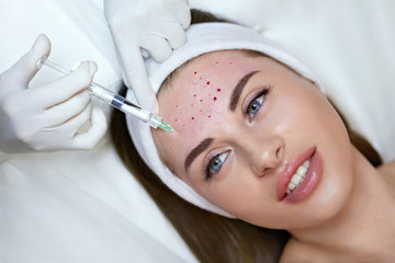 Face Treatment. Anti Aging Beauty Injection In Forehead. Skincare Rejuvenation Procedure In Cosmetic Clinic. Beautician Hands In Gloves With Syringe.