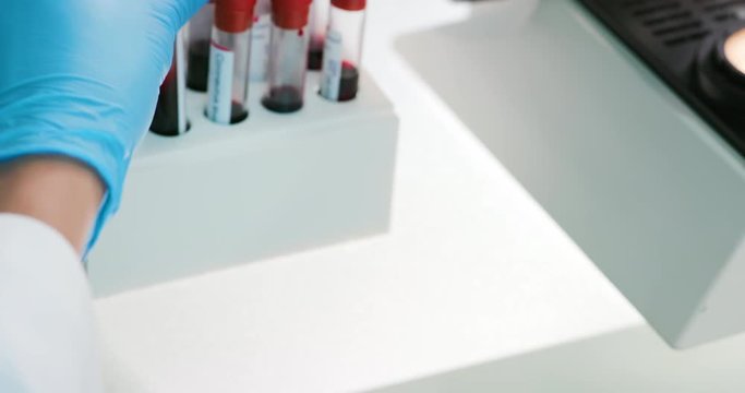 blood test result concept