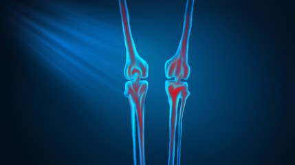 3d illustration of bone leg pain