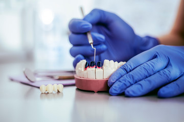 Detail view of a dentist working 