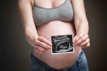 Pregnant Woman Holding a Sonogram or Ultrasound Picture of Her Baby