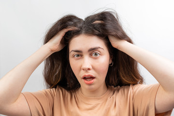 Dandruff, pediculosis and seborrhea. Portrait of a young Caucasian woman, a brunette in a beige...