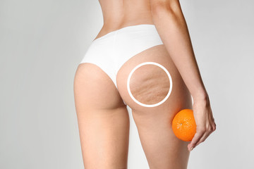 Young woman with orange on light background. Problem of cellulite - obrazy, fototapety, plakaty