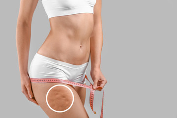 Young woman with cellulite problem using measuring tape on light background