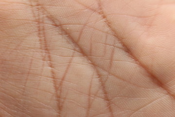 Palma de la mano
