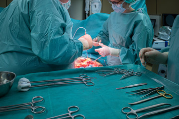 a surgical team performs a surgical abdominal operation