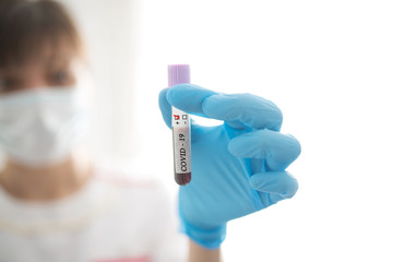 Female nurse holds test tube with blood sample with positive test COVID-19