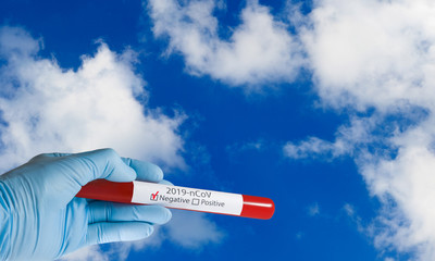 Fototapeta premium Image of test tube with coronavirus test in gloved hands
