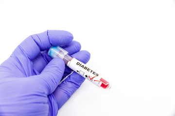 Obraz premium Closeup of microbiologist or medical worker hand with blue surgical gloves marking blood test result as positive for the diabetes. Diabetes Positive concept
