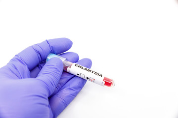 Obraz premium Closeup of microbiologist or medical worker hand with blue surgical gloves marking blood test result as positive for the chlamydia. Chlamydia Positive concept