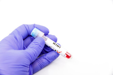 Fototapeta premium Closeup of microbiologist or medical worker hand with blue surgical gloves marking blood test result as positive for the H1N1. H1N1 Positive concept
