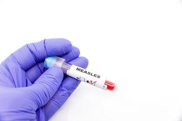 Obraz premium Closeup of microbiologist or medical worker hand with blue surgical gloves marking blood test result as positive for the measles. Measles Positive concept