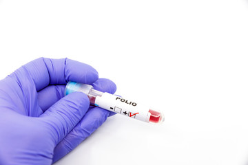 Fototapeta premium Closeup of microbiologist or medical worker hand with blue surgical gloves marking blood test result as positive for the polio. Polio Positive concept