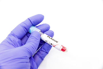 Fototapeta premium Closeup of microbiologist or medical worker hand with blue surgical gloves marking blood test result as positive for the plague. Plague Positive concept