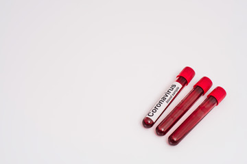 High angle view of test tubes with coronavirus blood samples on white background