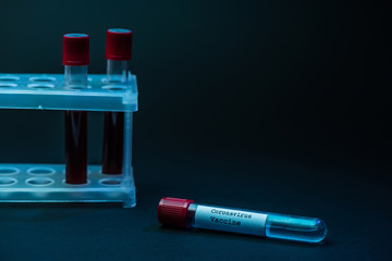 Coronavirus vaccine near test tube rack with blood samples on dark
