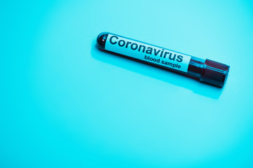 High angle view of test tube with coronavirus blood sample on blue background
