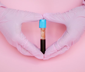 The doctor holds a test tube with blood. Research and analysis in the laboratory. Blood in a test...