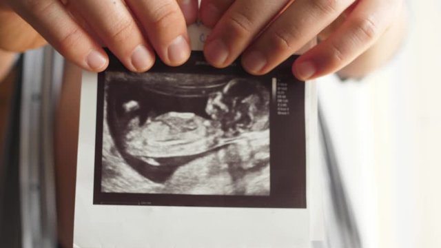 pregnant woman strokes her belly shows ultrasound picture to camera
