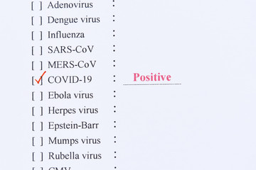 Positive test result of COVID-19 virus, novel coronavirus pandemic disease in 2020